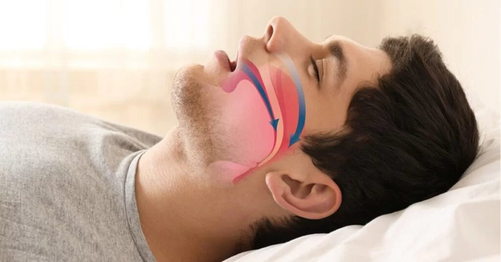 Chrapanie – skąd się bierze, dlaczego częściej dotyczy mężczyzn i co z nim zrobić?