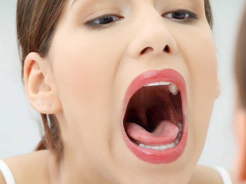 Czego nie powie Ci dentysta — czyli co się dzieje z Twoją jamą ustną, gdy oddychasz ustami?