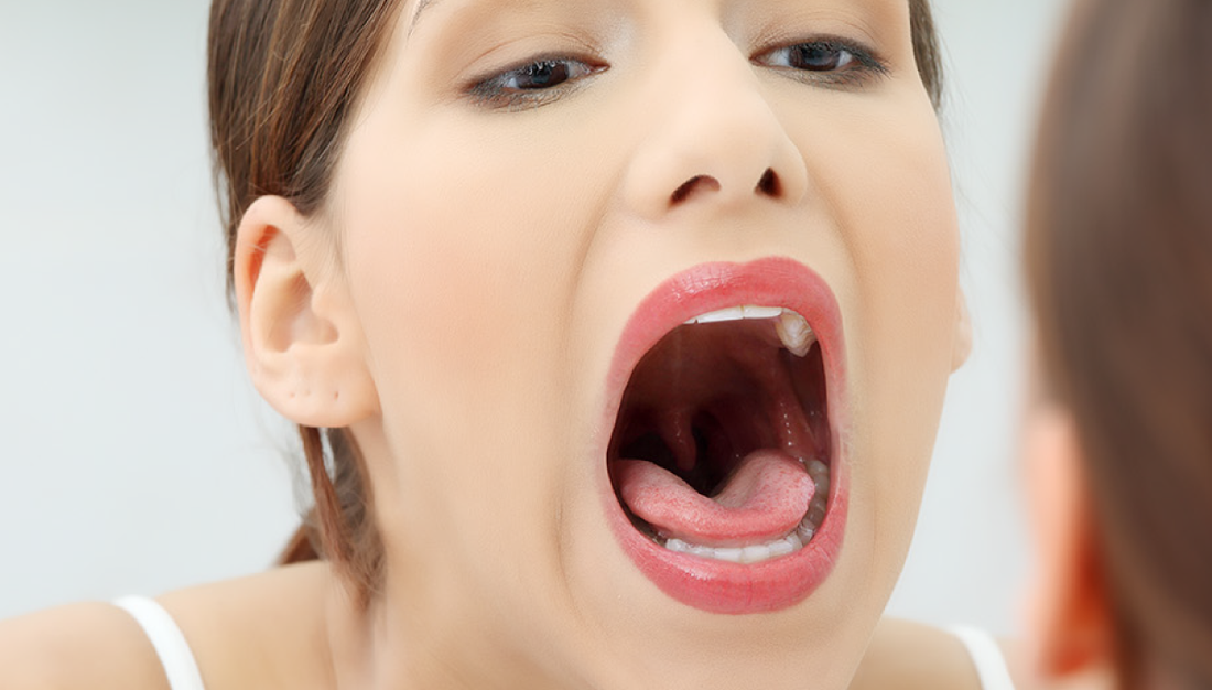 Czego nie powie Ci dentysta — czyli co się dzieje z Twoją jamą ustną, gdy oddychasz ustami?